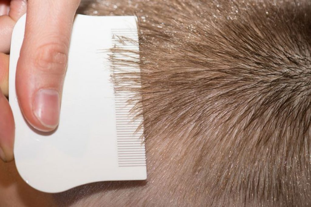 Гниды на волосах: что это, как выглядят, откуда берутся и чем лечить - удаление