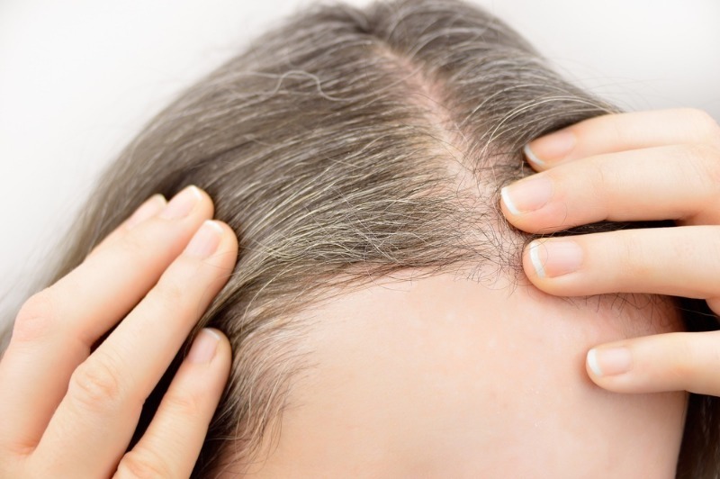 10 новейших способов остановить выпадение волос у женщин